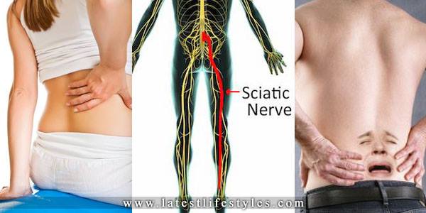 10 Best Natural Treatments for Sciatic Nerve Pain